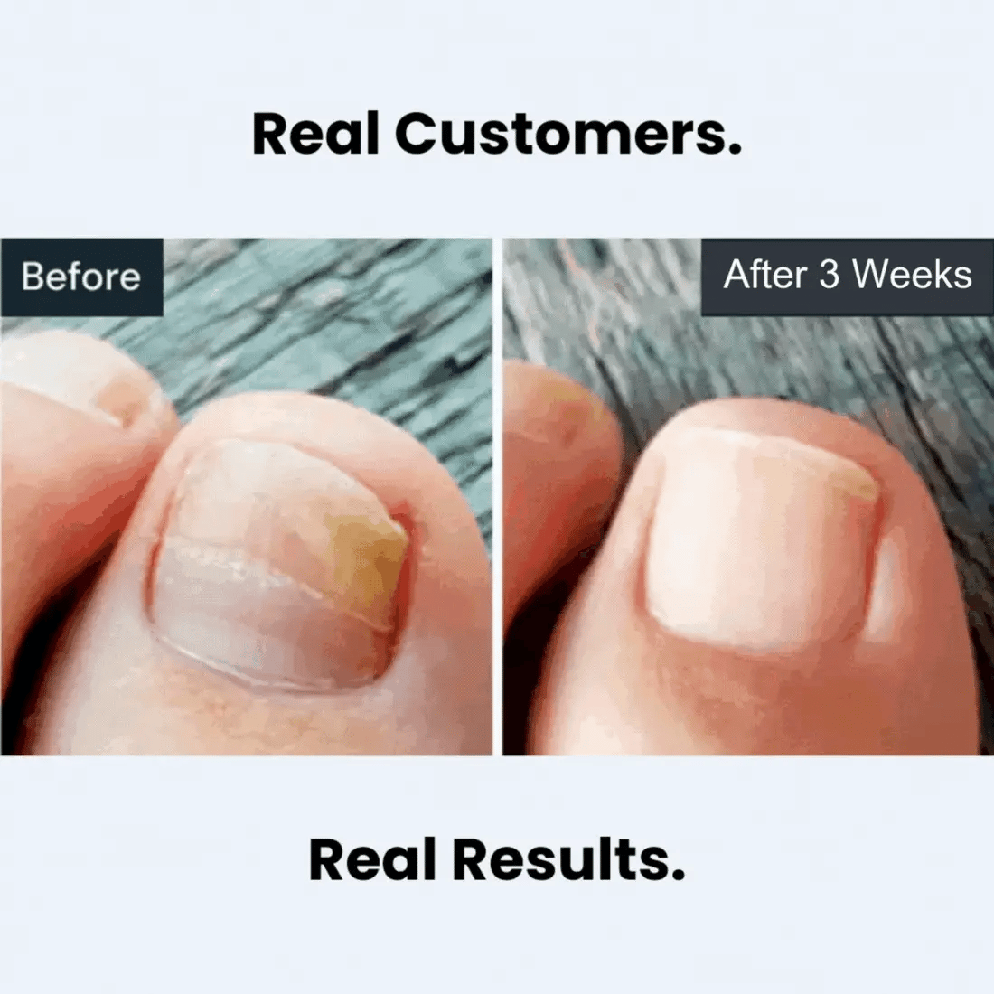 Nail Care Pen