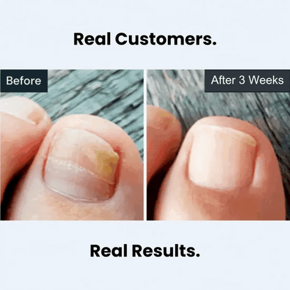 Nail Care Pen